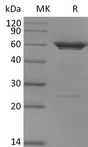 Recombinant Human PFKFB3 (N-6His)