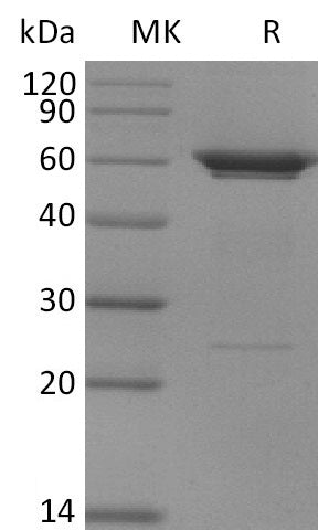 Recombinant Human PFKFB3 (N-6His)