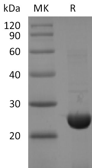 Recombinant 2019-nCoV NSP8 (C-6His)