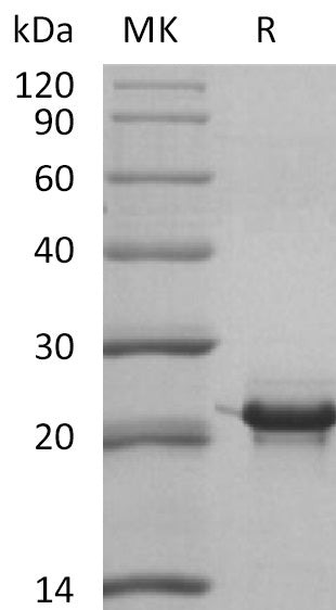 Recombinant Human KRAS4B (N-6His)