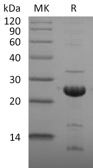 Recombinant 2019-nCoV NSP1 (C-6His)
