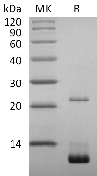 Recombinant 2019-nCoV NSP7 (C-6His)