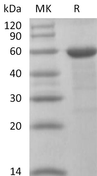 Recombinant Human BRD4 (N-10His-Flag)
