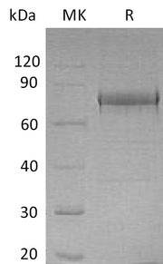 Recombinant Human EphA1 (C-6His)