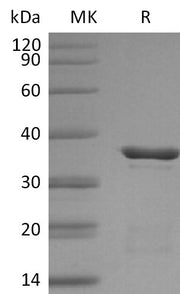 Recombinant Human Galectin-4 (C-6His)
