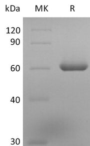 Recombinant Human TDT (N-6His)