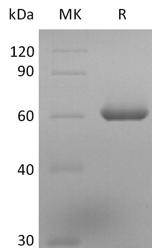 Recombinant Human TDT (N-6His)