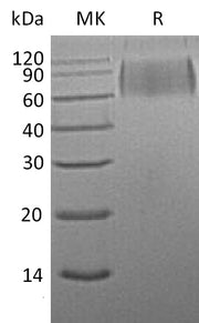 Recombinant Mouse SIRPA (C-6His)