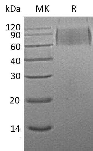 Recombinant Mouse SIRPA (C-6His)