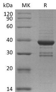 Recombinant Human MKI67 (N-GST)