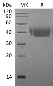 Recombinant Mouse DNAM-1 (C-6His)