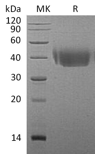 Recombinant Mouse DNAM-1 (C-6His)