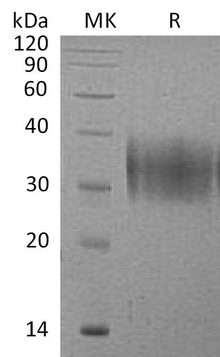 Recombinant Mouse VISTA (C-6His)