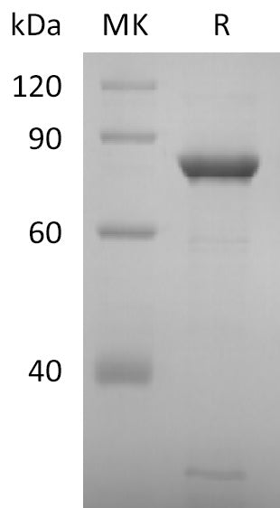 Recombinant 2019-nCoV NSP2 (C-6His)