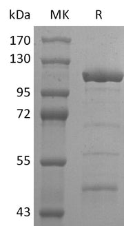 Recombinant 2019-nCoV Helicase (N-6His-MBP)