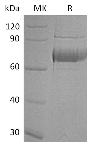Recombinant Human OLFM4 (C-10His)
