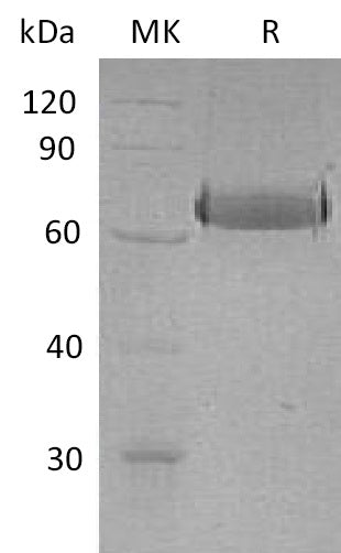 Recombinant Human EphA2 (C-6His)