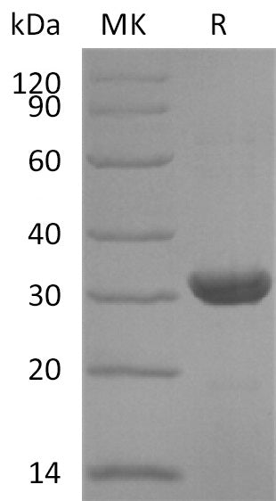 Recombinant Human NNT (N-6His)