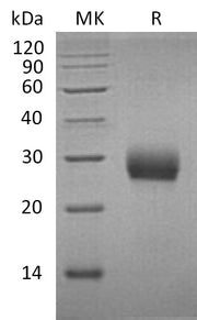 Recombinant Mouse RANK (C-6His)