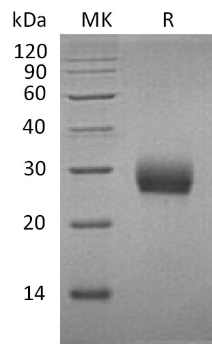 Recombinant Mouse RANK (C-6His)