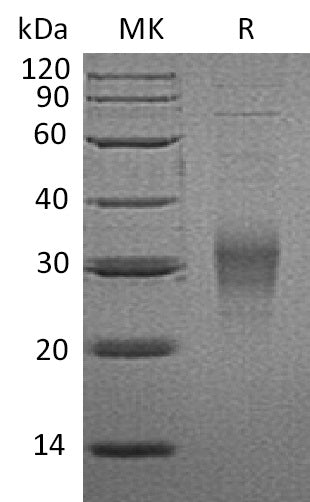 Recombinant Mouse FcgR4 (C-6His)