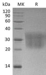 Recombinant Mouse CCL2 (C-6His)