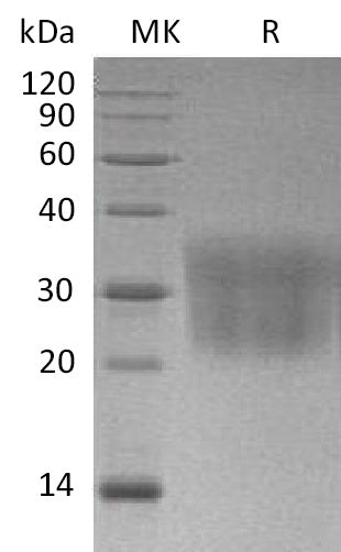 Recombinant Mouse CCL2 (C-6His)