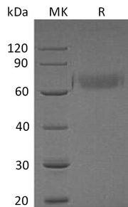 Recombinant Human HYOU1 (C-10His)