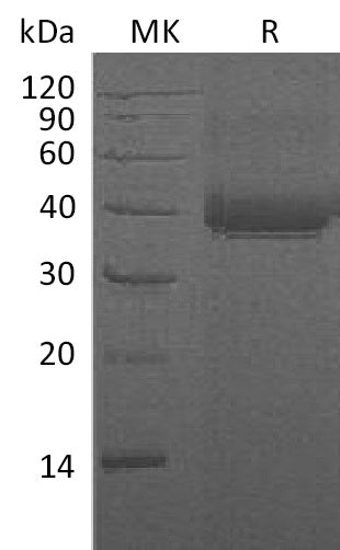 Recombinant Human CD23 (N-8His)