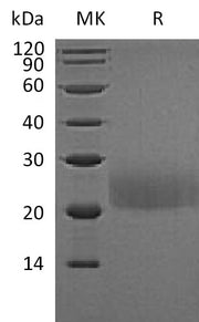 Recombinant Mouse CTLA-4 (C-Flag)