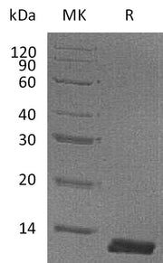Recombinant Mouse CCL8 (C-6His)