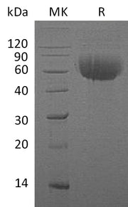Recombinant Human IL-13RA1 (C-6His)