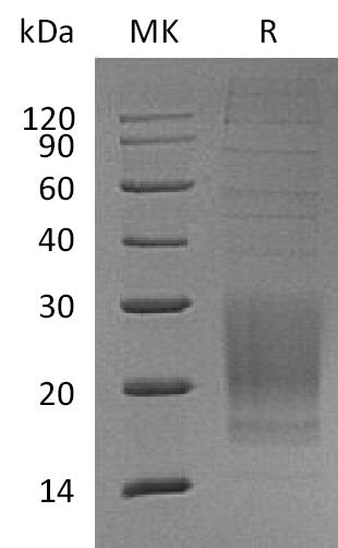 Recombinant Mouse ICOS (C-6His)