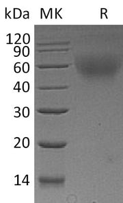 Recombinant Mouse CD30 (C-6His)