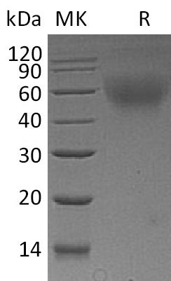 Recombinant Mouse CD30 (C-6His)