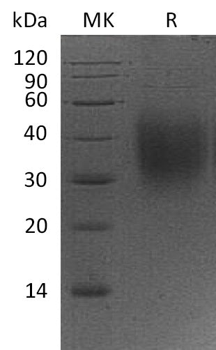 Recombinant Mouse CD47 (C-6His)