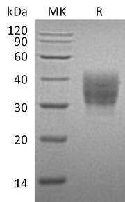 Recombinant Mouse SLAMF7 (C-6His)