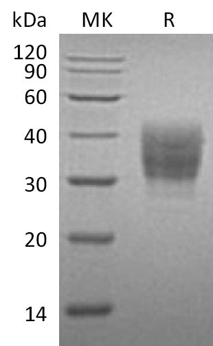 Recombinant Mouse SLAMF7 (C-6His)