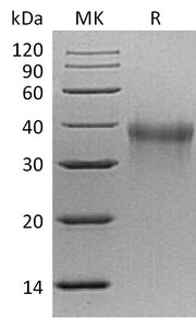 Recombinant Mouse TREM-1 (C-6His)