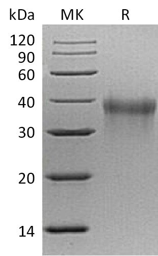Recombinant Mouse TREM-1 (C-6His)
