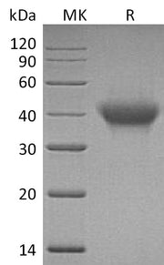 Recombinant Human IL-5RA (C-6His)