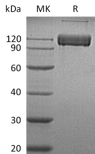Recombinant Human ALCAM (C-Fc)