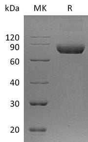 Recombinant Human IL-5RA (C-Fc)