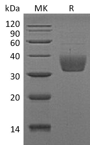Recombinant Mouse SLAMF8 (C-6His)