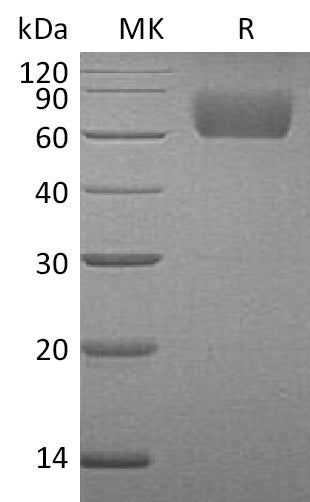 Recombinant Human FGF R3 (C-6His)