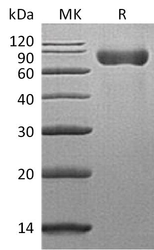 Recombinant Mouse SLAMF3 (C-6His)