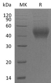 Recombinant Mouse SLAMF2 (C-6His)