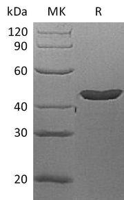 Recombinant Human Lefty-A (N-6His)