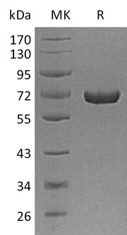 Recombinant Human AFP (C-6His)