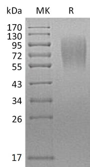 Recombinant Mouse LAMP-1 (C-6His)